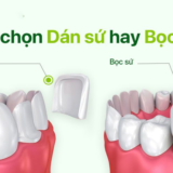 Dan su hay boc su