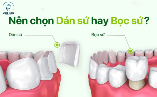 Dan su hay boc su