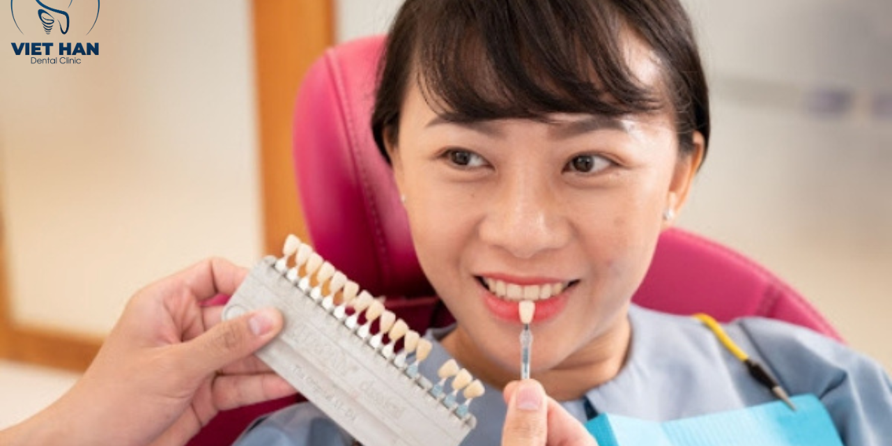 Bật mí: Cách chọn màu răng sứ hài hòa với da và gương mặt