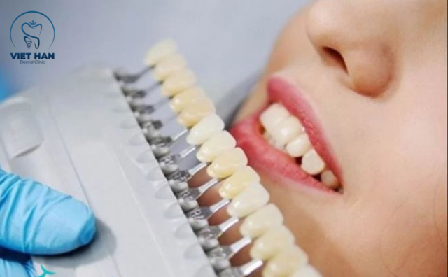 Màu sứ phù hợp với dáng răng