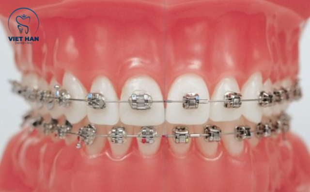 nieng rang mac cai 3M