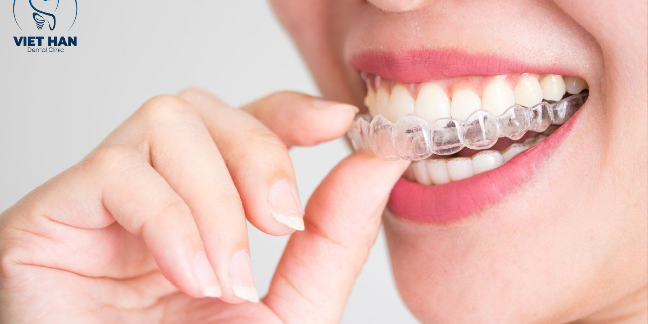 Cách chăm sóc – vệ sinh – đeo hàm đúng chuẩn khi niềng khay