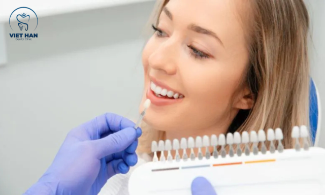 Dán sứ veneer cho răng thưa giúp cải thiện màu sắc, hình dáng răng tự nhiên.