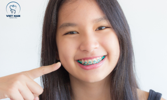 Chọn đúng tuổi niềng răng giúp răng dịch chuyển thuận lợi hơn và giảm thời gian điều trị.