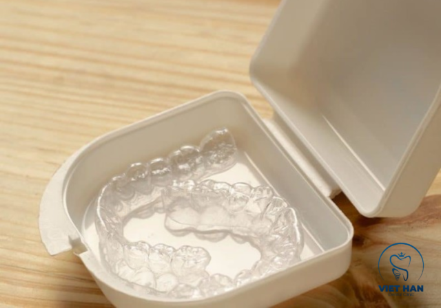 Đeo hàm duy trì đúng cách giúp nụ cười đều đẹp và khớp cắn ổn định theo thời gian.