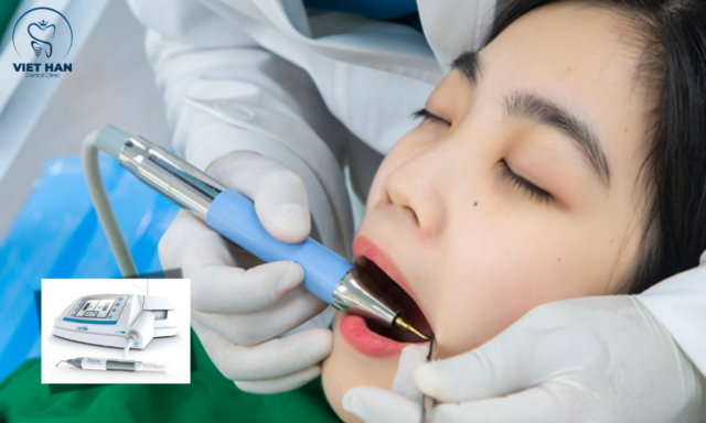 Nhổ răng khôn bằng máy siêu âm Piezotome với thao tác chính xác.