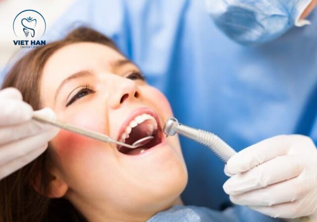 Đánh răng đúng cách kết hợp cạo vôi răng định kỳ giúp hạn chế cao răng tích tụ.