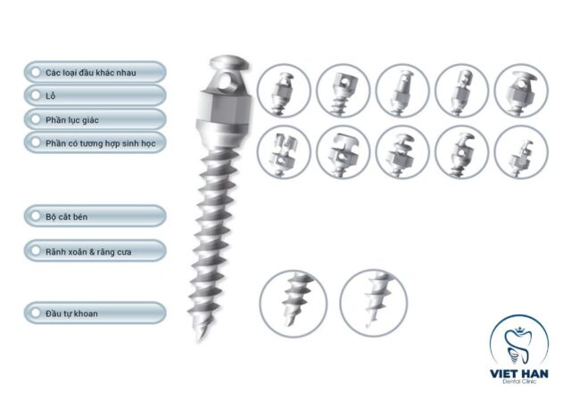 Minivis được chỉ định trong các ca khó, giúp định hướng răng khác với quá trình thay răng sữa tự nhiên.