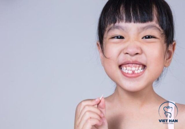 Niềng răng trẻ em giúp phát hiện sớm sai lệch và điều chỉnh kịp thời