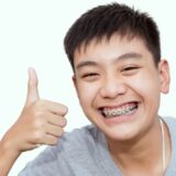 Can thiệp sớm bằng niềng răng trẻ em giúp răng dịch chuyển dễ hơn