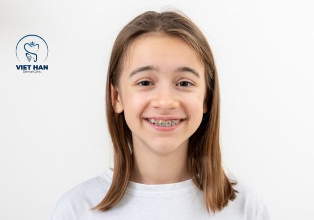 Cảm giác khi niềng răng trẻ em thường nhẹ và nhanh thích nghi