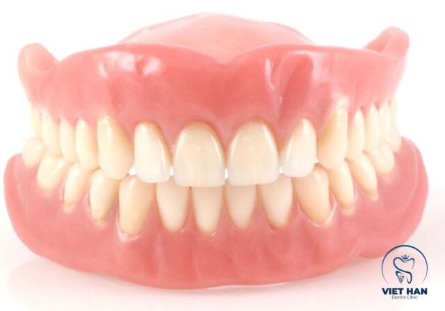 Cấu tạo của hàm giả trong trồng răng tháo lắp gồm nền hàm và răng giả ôm sát cung hàm.