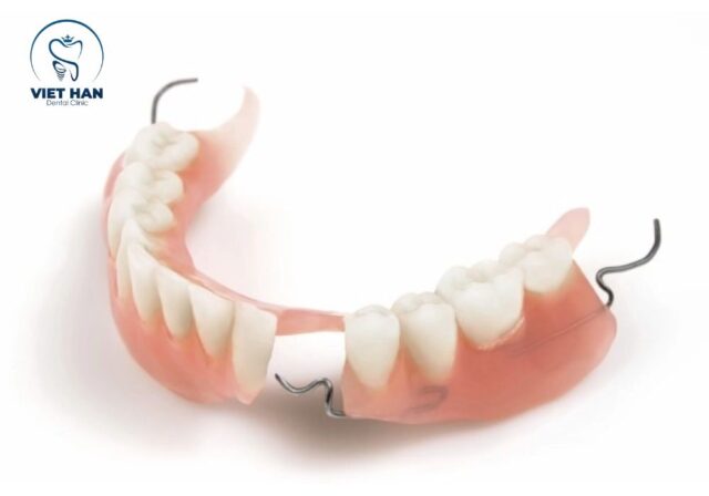 Quy trình trồng răng tháo lắp bắt đầu bằng thăm khám và đánh giá tình trạng răng miệng.