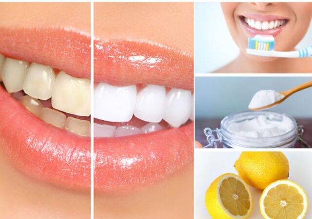Chăm sóc đúng cách giúp cải thiện răng vàng và hạn chế mảng bám hiệu quả.