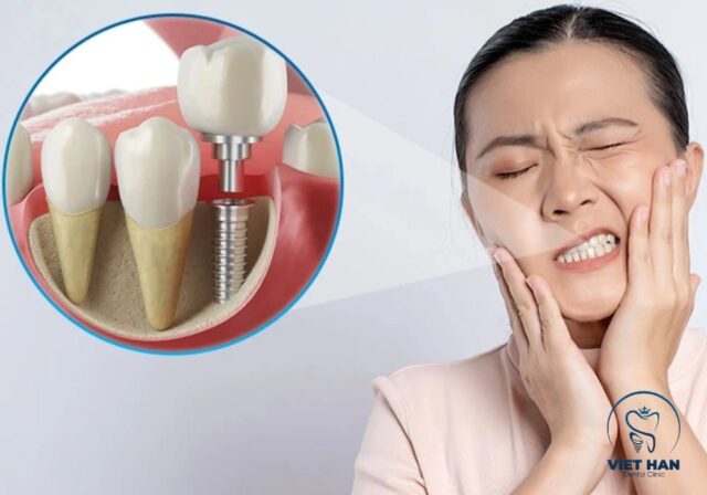 Cắm implant có đau không? Quá trình cấy ghép được gây tê nên hầu như không gây đau.