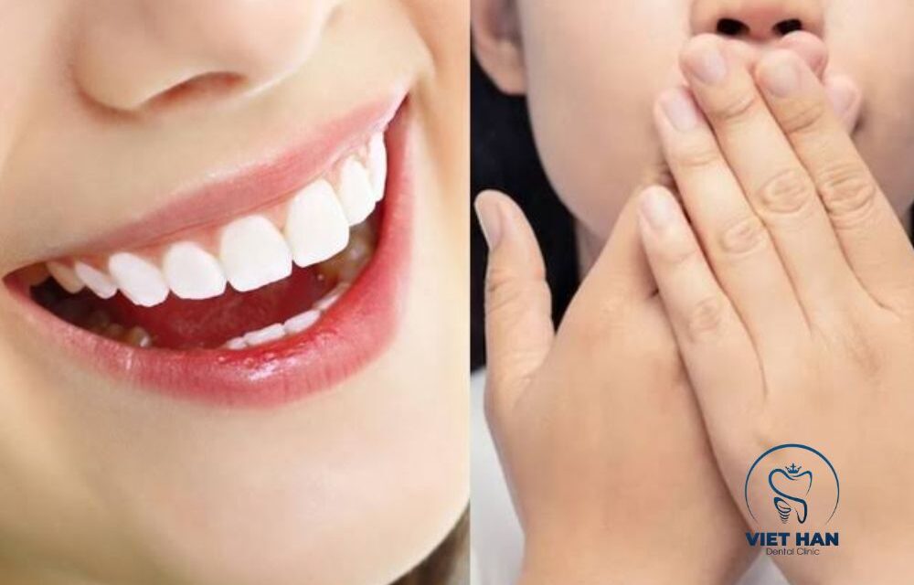 Làm Răng Sứ Có Hôi Miệng Không? Nguyên Nhân – Cách Khắc Phục
