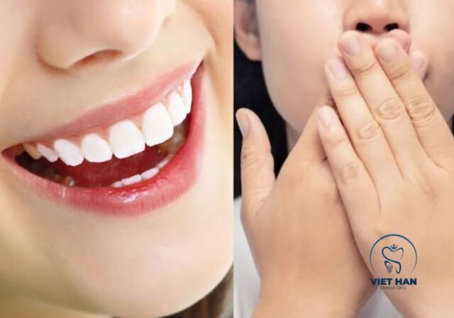 Làm răng sứ đúng kỹ thuật và chăm sóc tốt giúp hạn chế nguy cơ hôi miệng.