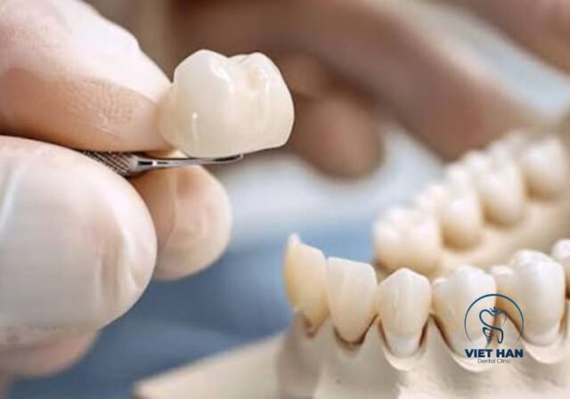 Tái khám định kỳ giúp kiểm tra độ khít sát và tình trạng răng sứ, nướu.
