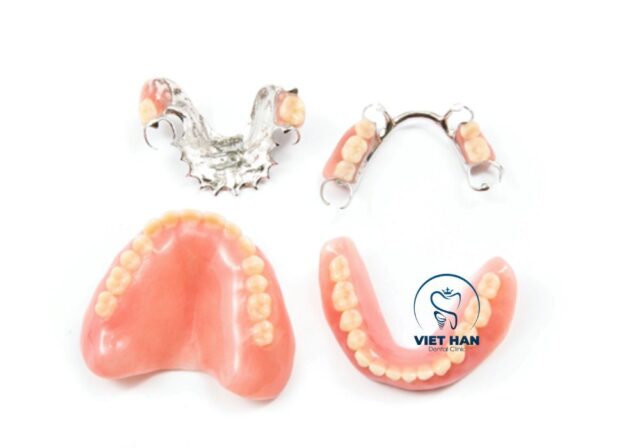 Hàm răng giả tháo lắp là phương pháp trồng răng giả tiết kiệm
